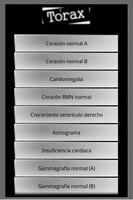 Radiografias de examenes