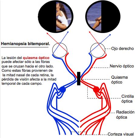 Campimetria