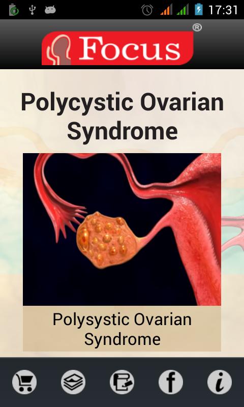 Polycystic ovarian syndrome