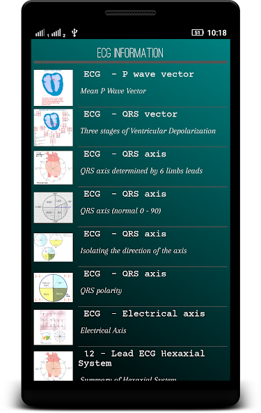 ECG Interpretation Basic
