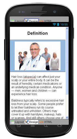 Hair Loss Disease & Symptoms