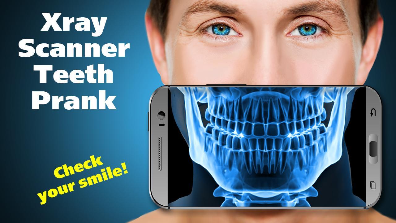 Xray Scanner Teeth Prank