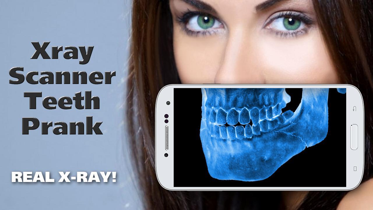 Xray Scanner Teeth Prank